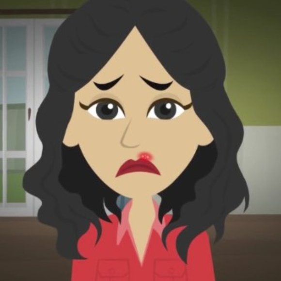 Virulite The Only FDA Approved Cold Sore Treatment Device - Picture 5 of 17